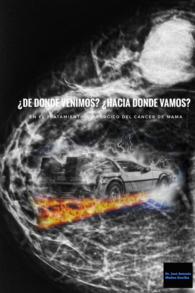 Mamografía con imagen superpuesta de un De Lorean como el usado en la película "Back to the Future"