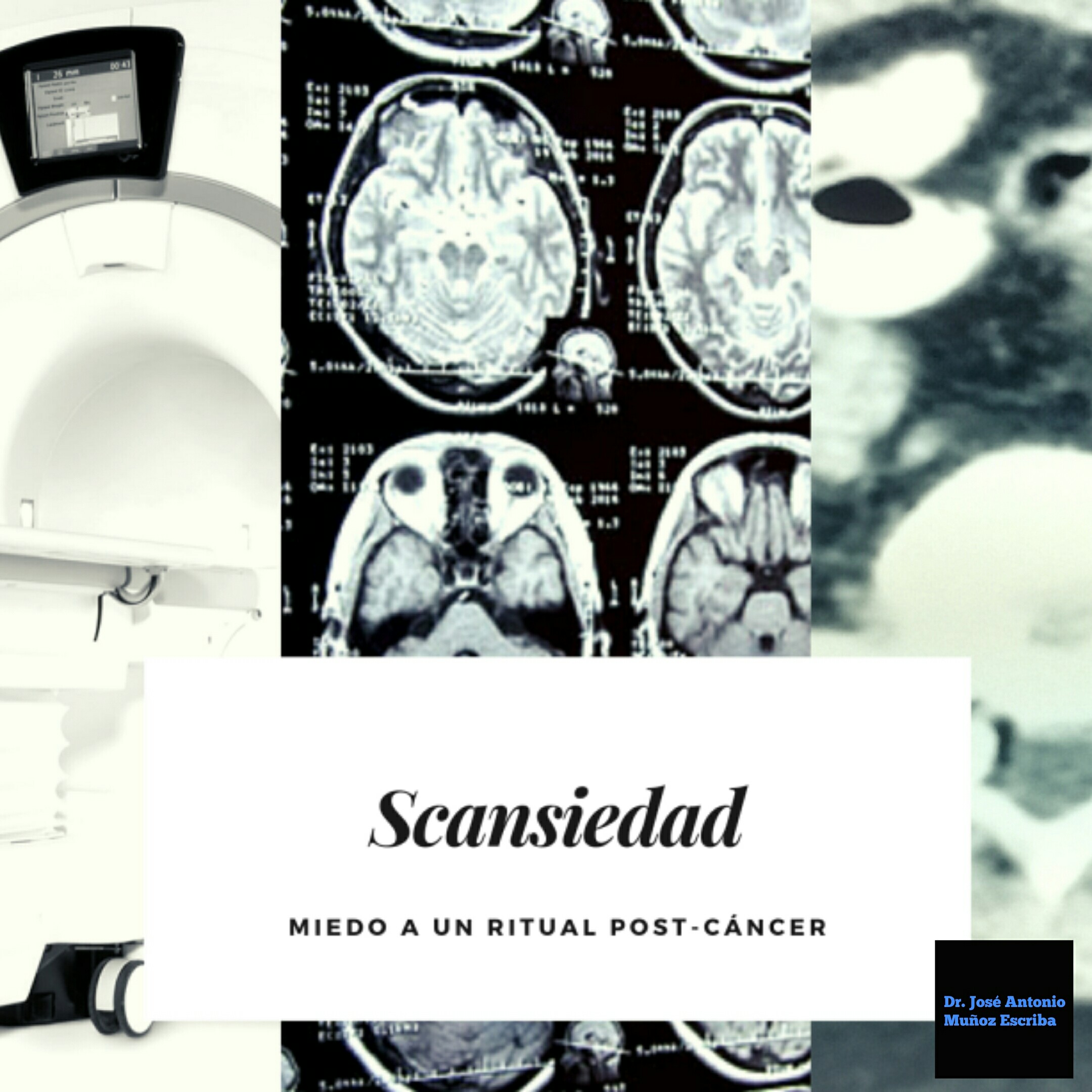 Collage de imágenes de una resonancia magnética, una TAC y un tomógrafo