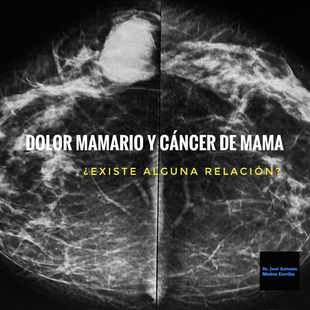 Mamografía con la imagen de un tumor hacia los cuadrantes externos