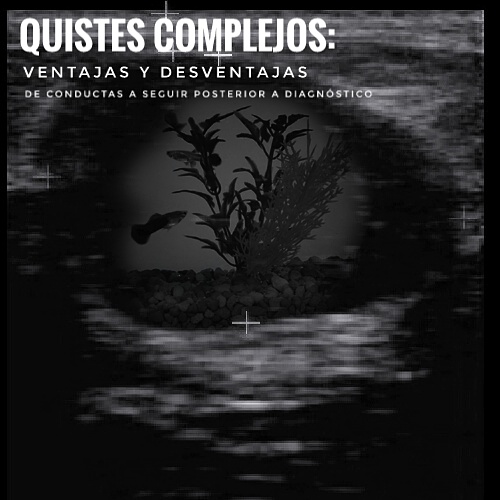 Quiste mamario al ultrasonido donde se observa en su interior la imagen superpuesta del contenido de una pecera donde hay peces, vegetación y un fondo empedrado. Evoca a las características de un quiste complejo mamario