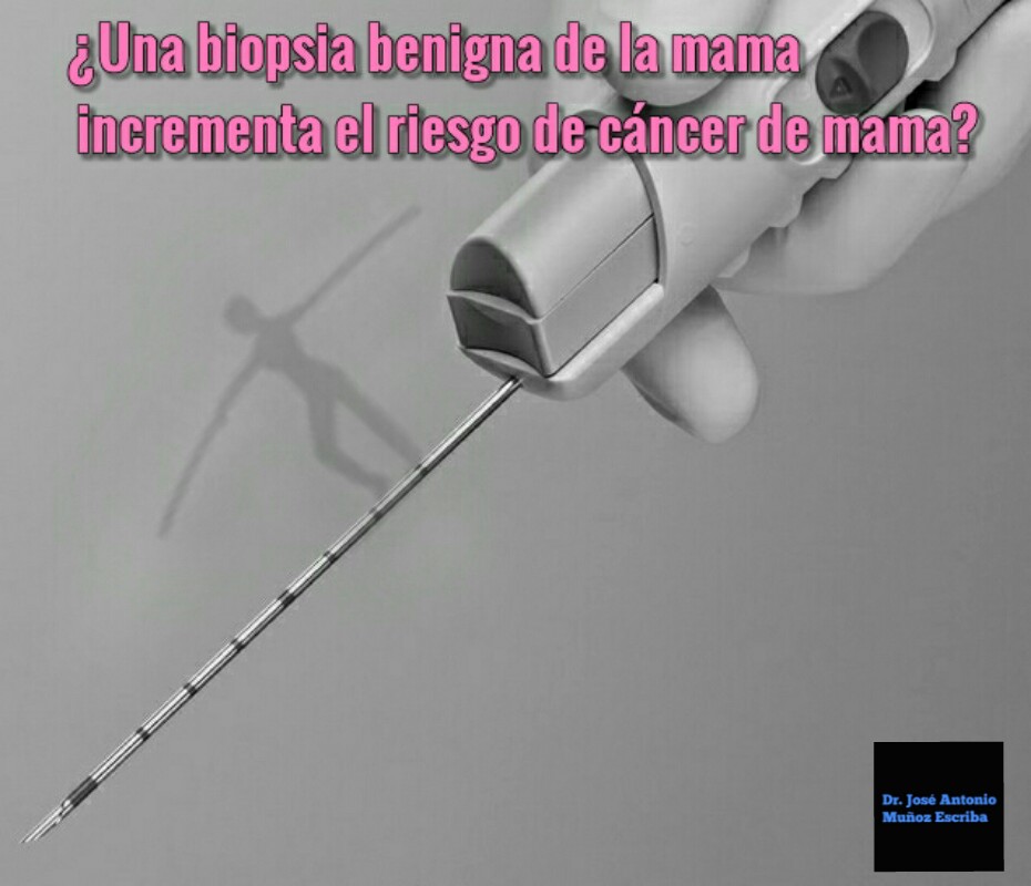 Una mano con guante de latex sosteniendo una aguja de trucut automática. Imagen en blanco y negro