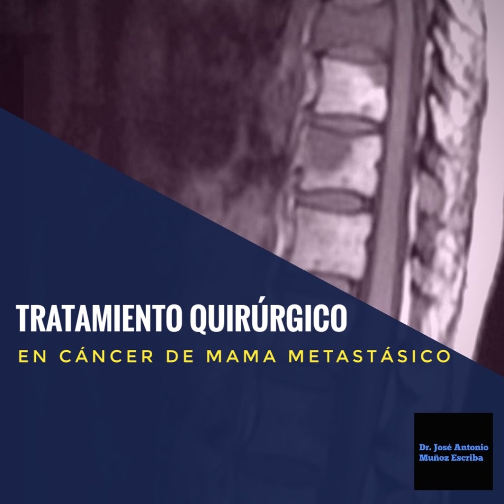 Resonancia magnética de columna lumbar con una sugestiva de una metástasis ósea 