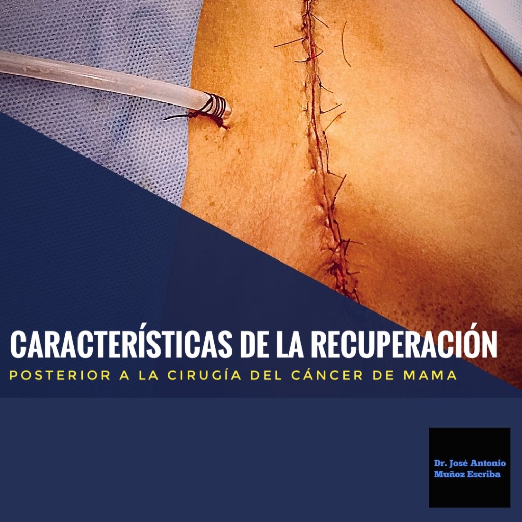 Imagen de un postoperatorio inmediato de una mastectomía en la que se observa la herida operatoria con puntos de sutura y la salida de un dren aspirativo cerrado debajo de la incisión