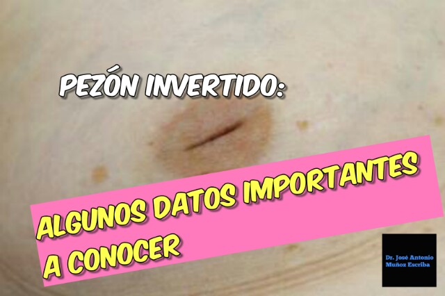 Imagen de un pezón invertido de una mujer blanca. En el texto se puede leer: "pezón invertido: algunos datos importantes a conocer