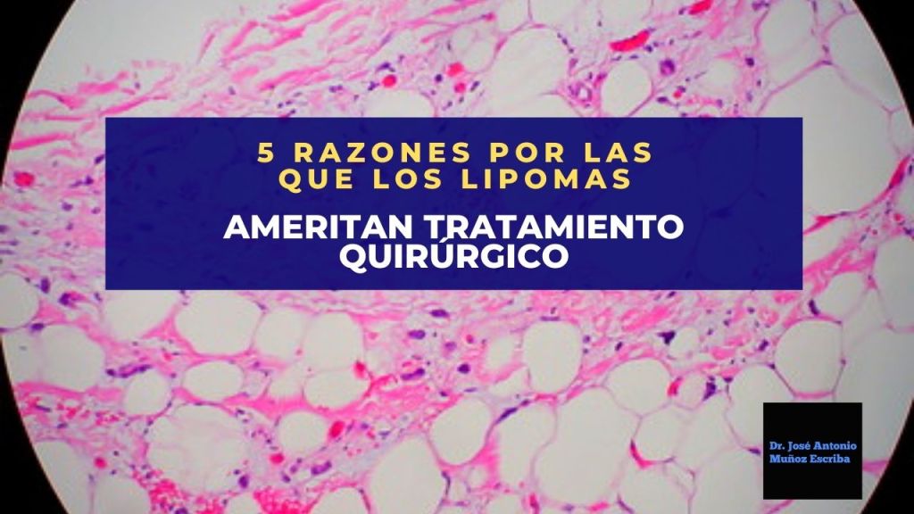 Imagen al microscopio del tejido adiposo donde se observan múltiples adipocitos en un fondo de tejido conectivo