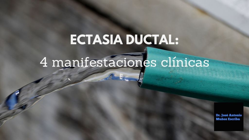 Imagen de una manguera verde por la que sale agua en su extremo