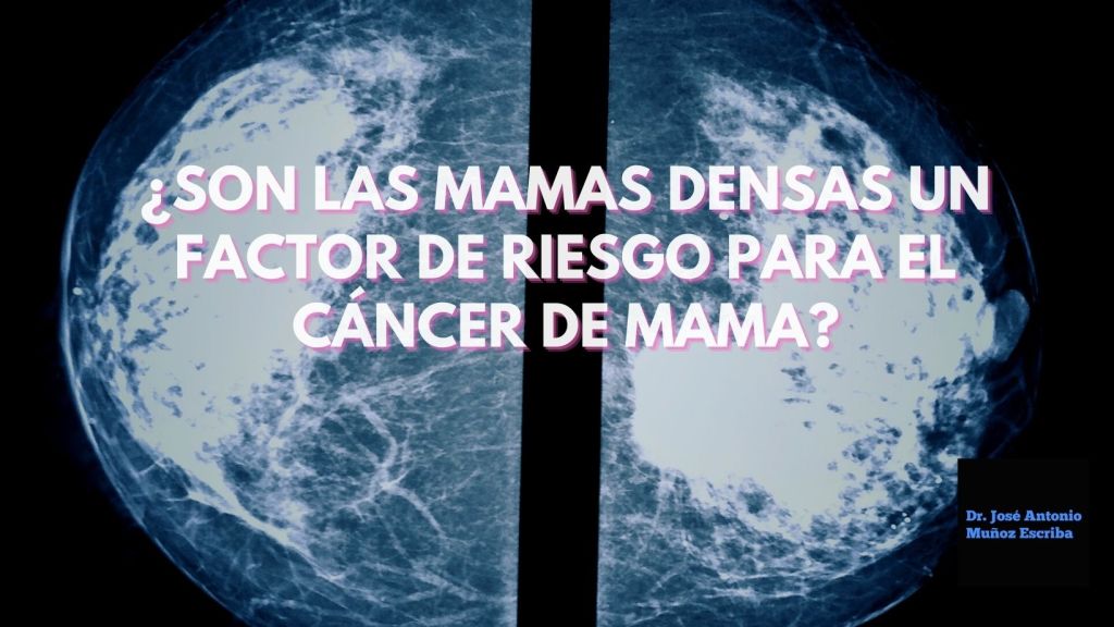 Mamografía en la que se observa en proyecciones craneo-caudales las imágenes de la mama derecha y la mama izquierda en la que se observa la presencia de un tumor radiodenso ubicado hacia la parte central de dicha proyección, enmascarada por el aumento de densidad de las mamas de la mujer que está siendo evaluada. Autor de la foto: José Antonio Muñoz Escriba 