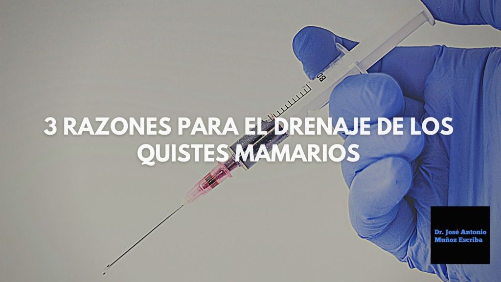 Imagen de una mano con guante de latex azul, sosteniendo una inyectadora que podría ser utilizada para el drenaje de un quiste mamario