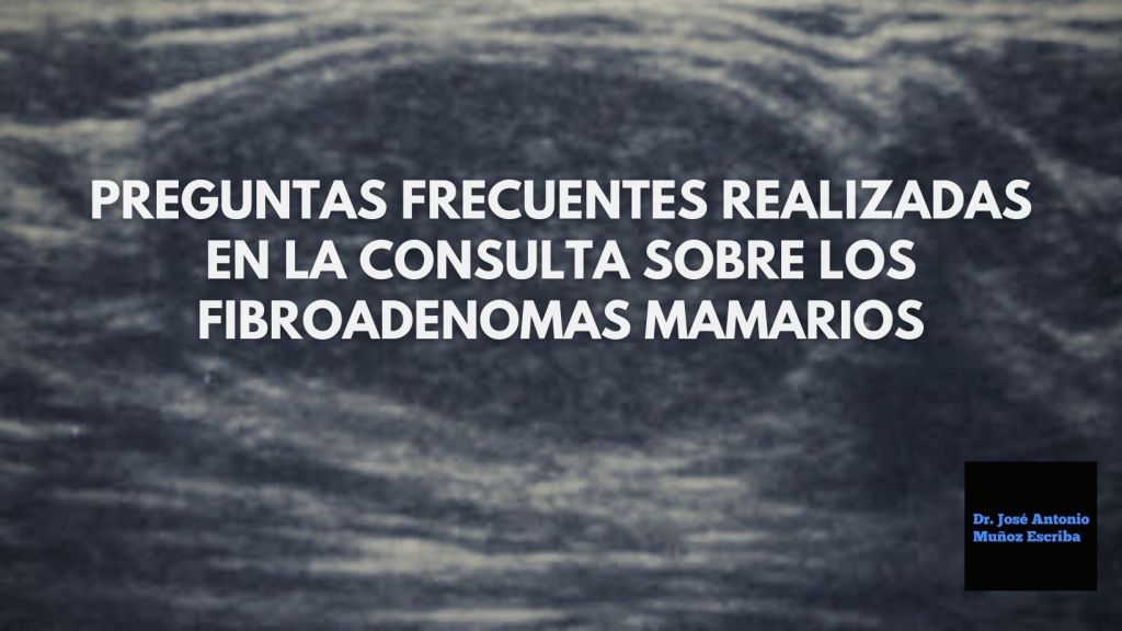 Imagen de un ecosonograma de una lesión hipoecoica mamaria, de bordes definidos, ovalada, con diámetro horizontal mayor al vertical. Esta imagen es compatible con un fibroadenoma