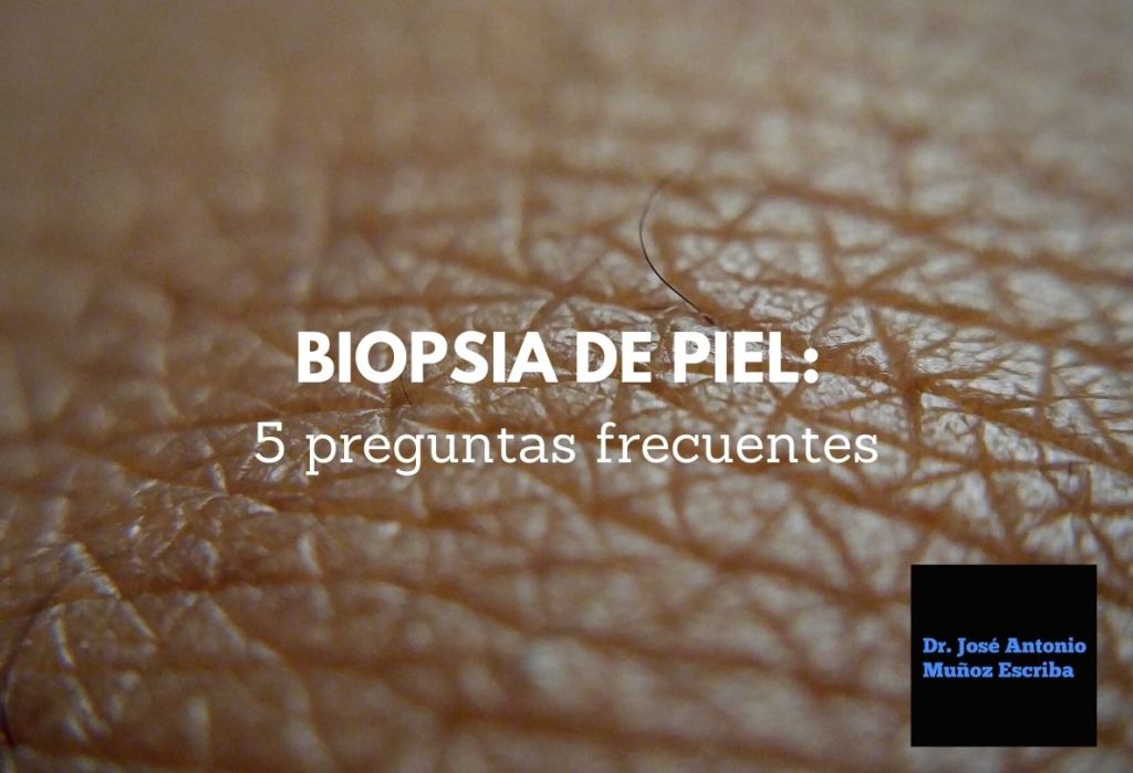 Imagen de la piel vista desde un àngulo muy cercano