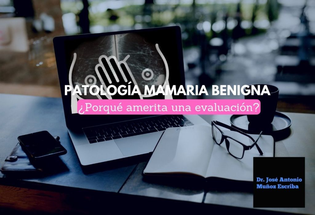 Una laptop sobre una mesa en la se ve en su pantalla una mamografía con una imagen superpuestade un esquema de unas mamas siendo evaluadas por el sketch de una mano