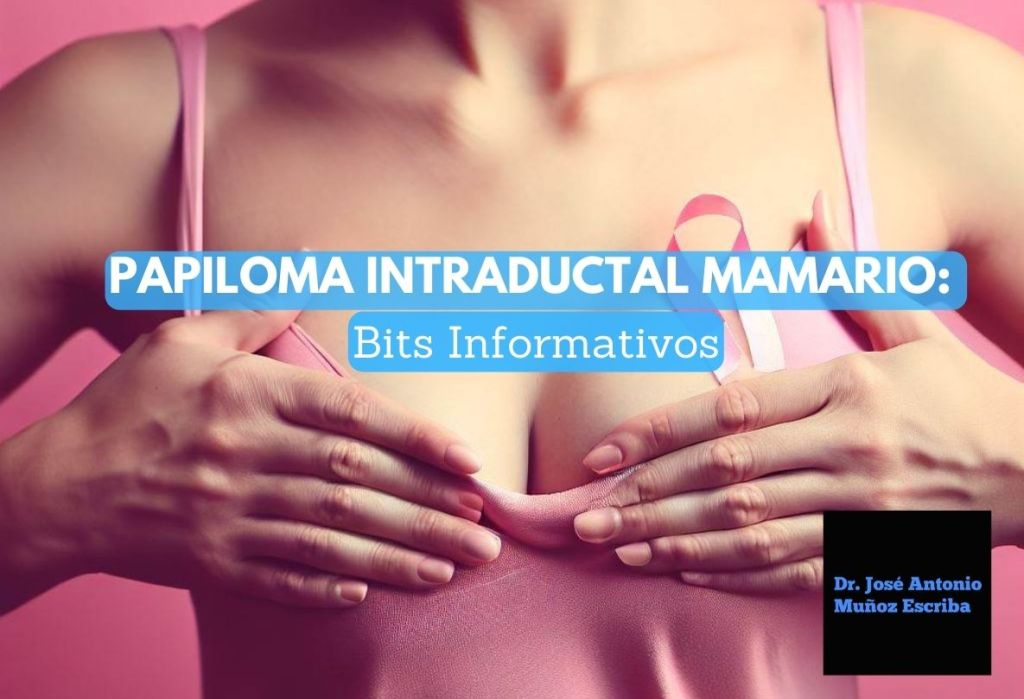 Mujer vestida de rosado portando un lazo rosado, símbolo de la lucha contra el cáncer de mama, comprime el seno derecho tratando de reproducir la telorragia que mancha su sujetador. La causa probable es un papiloma intraductal