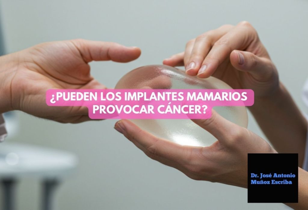 Protesis mamaria siendo sostenida por las manos de un cirujano oncólogo palpándole su consistencia y transfiriéndosela a las manos de una paciente que le pregunta si los implantes mamarios podrían ocasionarle un cáncer de mama