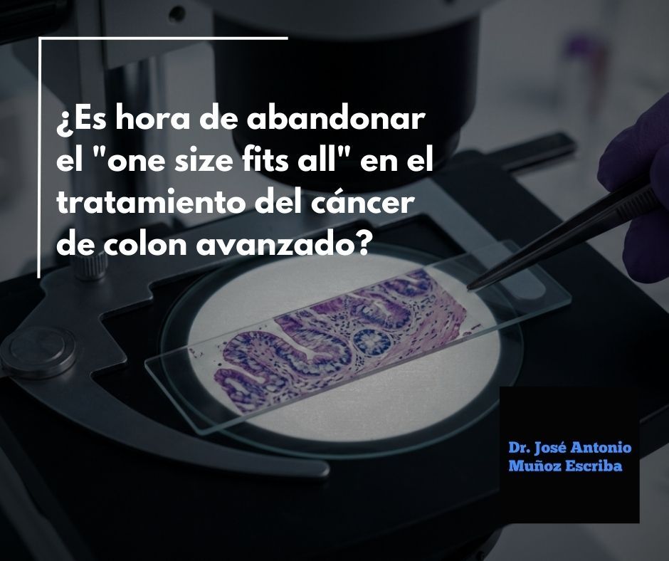 Imagen de una biopsia de un cáncer de colon examinada en el microscopio por un patólogo