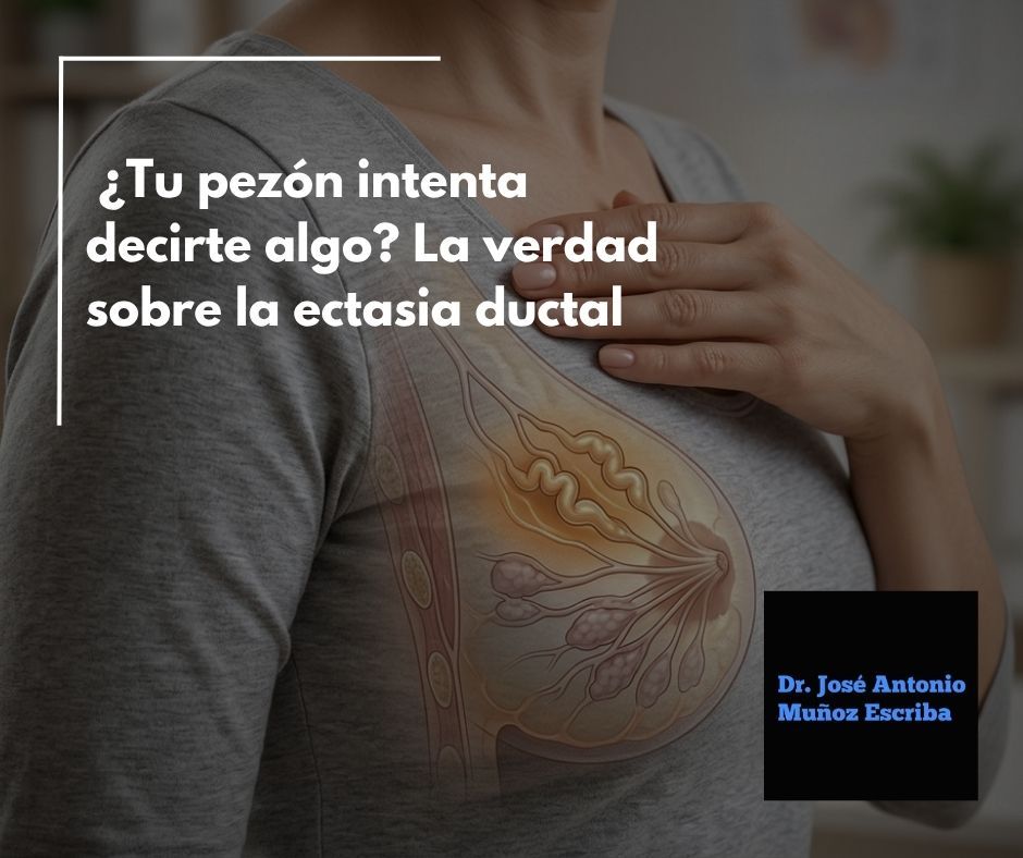 Mujer en fondo oscuro en la que se le observa los ductos mamarios dilatados producto de una ectasia ductal.